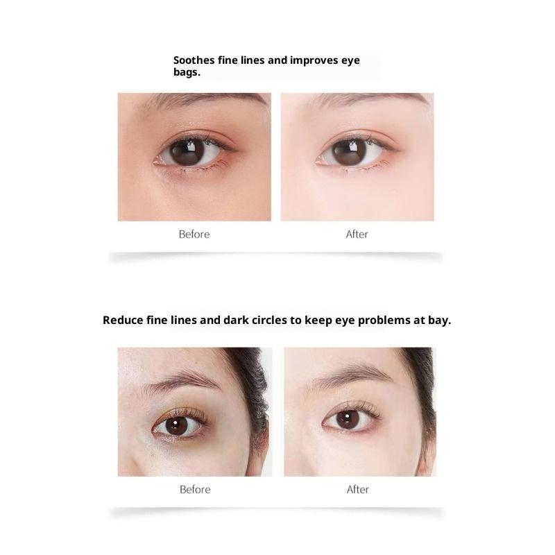 Retinol A Ester Ensoothe Nourishing, Hydrating and Tightening Eye Repair Cream Desalinates Fine Lines