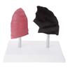 Anatomically Accurate Smoker Lung Comparison Model With Healthy Lung PVC Substance For Clinical Education