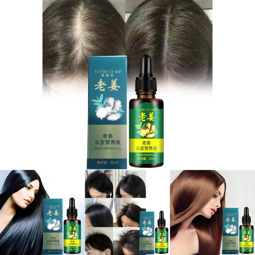 Nourishing Ginger Hair Essence For Healthy And Shiny Locks With Oil Control Benefits