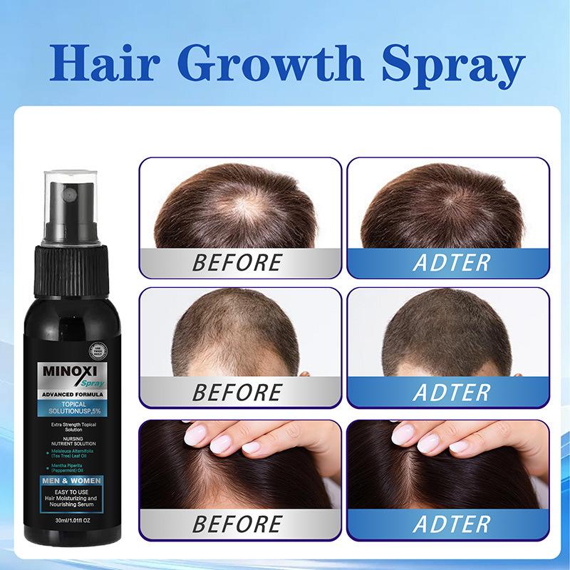 Biotin Hair Growth Spray Minoxidil Scalp Treatment Nourish Hair Roots Thickening for Men and Women 150ml