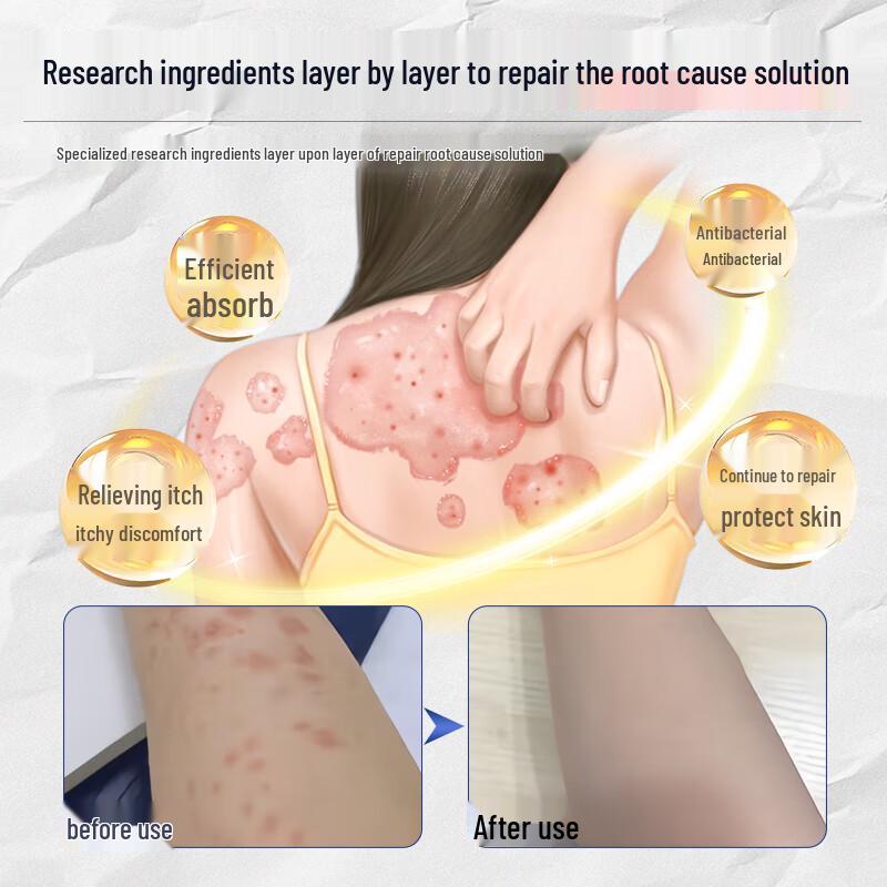 Jiubu Pharmaceutical Multi-Purpose Itch Relief Cream