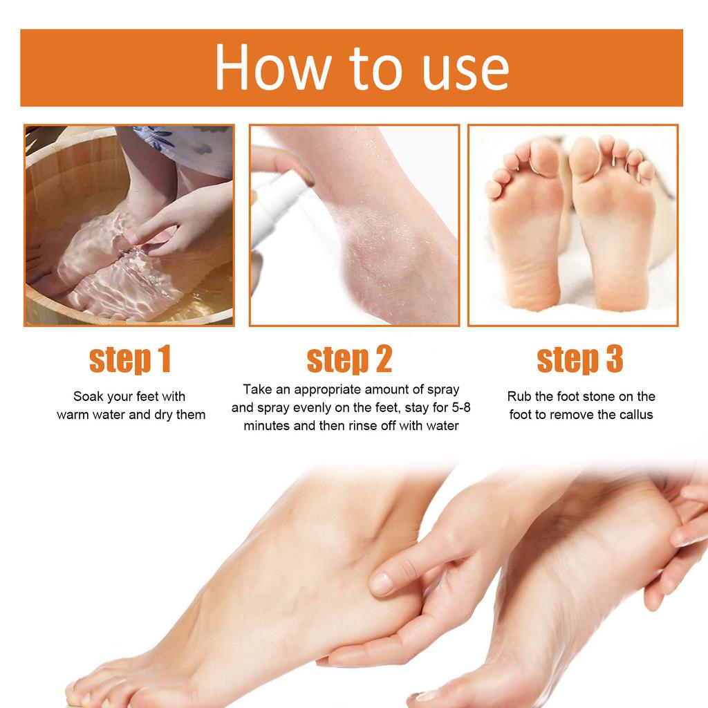South Moon Foot Exfoliating Spray Moisturizing Dead Skin Removal Hydrating