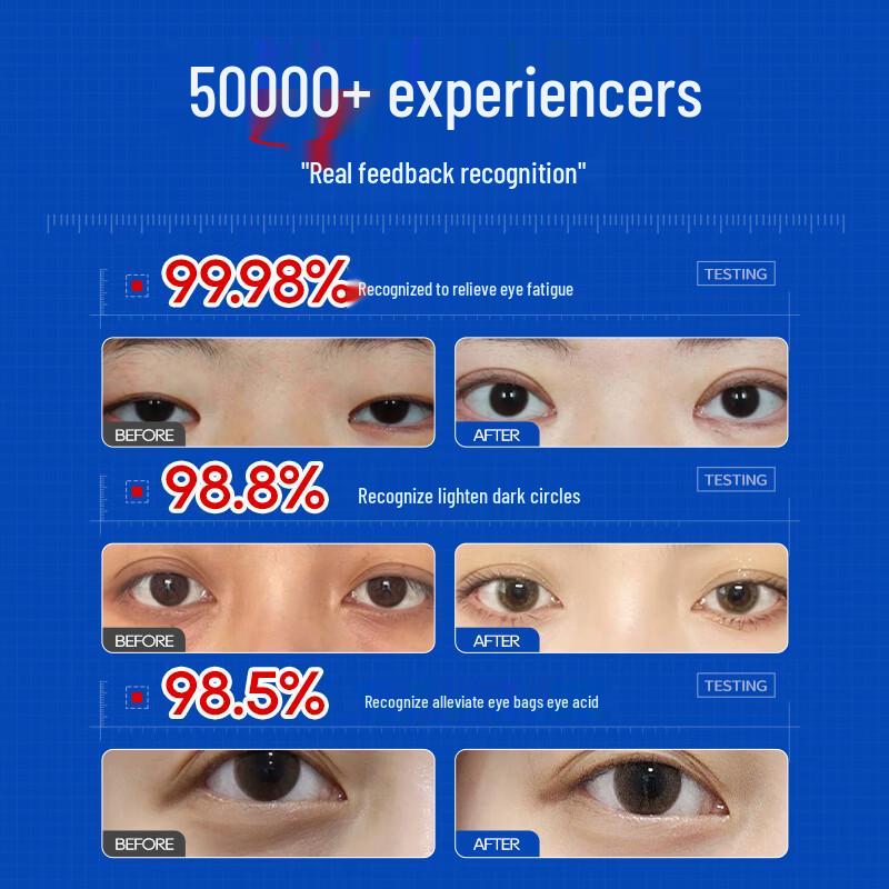 Shigang Lutein Steam Eye Mask
