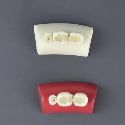 1 modelo de relleno oral, modelo de ejercicio de incrustación dental, bloque de relleno, material de resina tipodonto para enseñanza de odontología