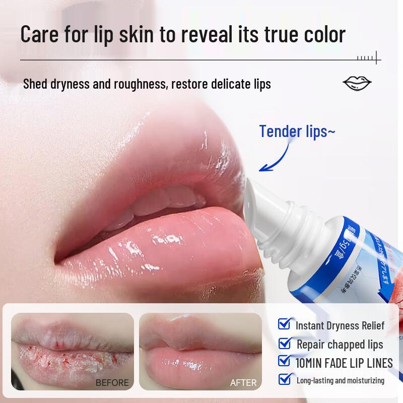 Feuchtigkeitsspendender Lippenbalsam für trockene, rissige Lippen & Cheilitis