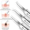 Ultra-Fine Pimple and Blackhead Extraction Tool – Precision Tweezers for Deep Pore Cleansing and Facial Skin Care
