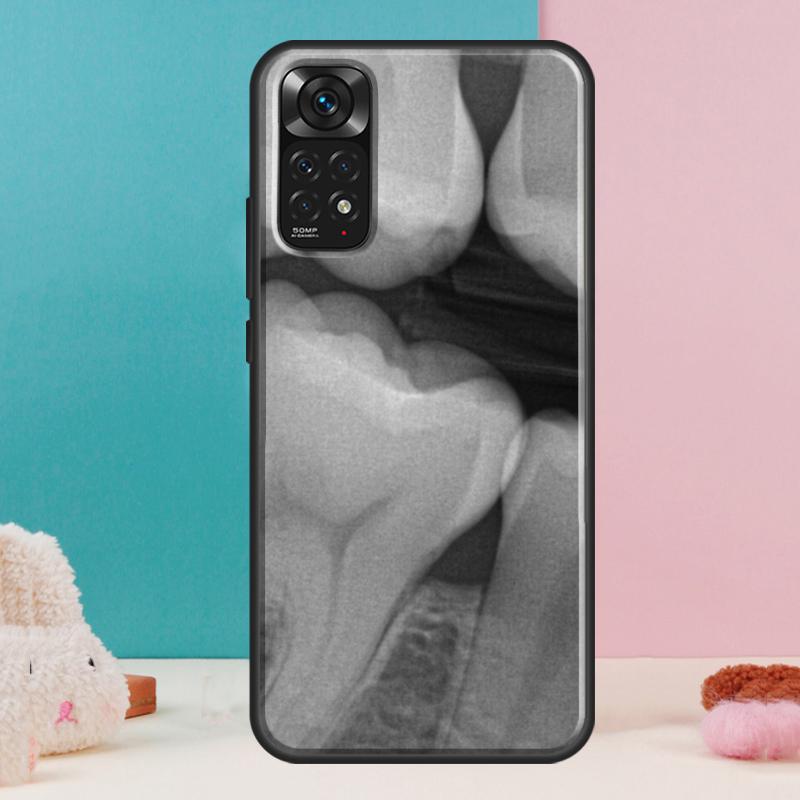 Zahnarzt Zahn Zahndose Für Xiaomi Redmi Note 14 13 Pro 12 11 9 10 9S 10S 11S 12S Redmi 14C 13C 10C 12C Hülle