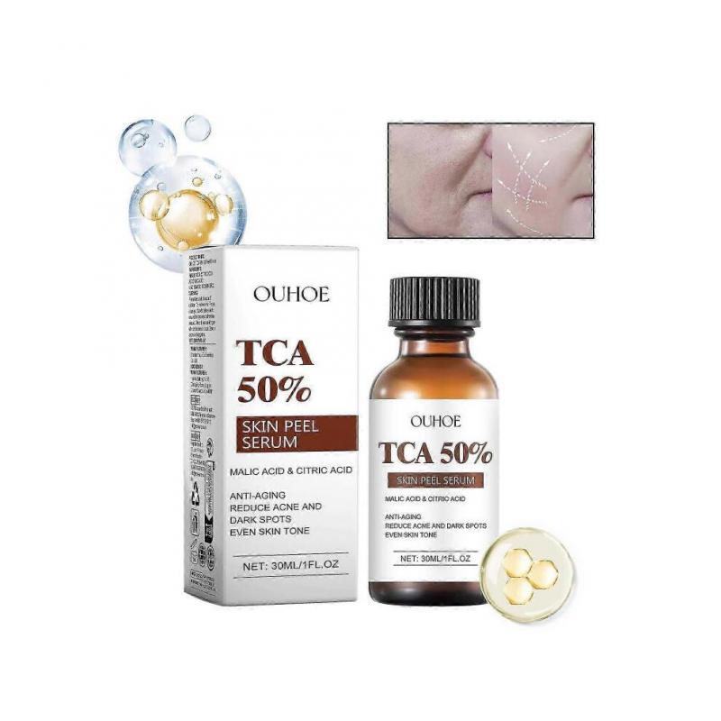 Citric Peeling Serum Chemical Peel for Face Peeling Solution Peel Chemical Exfoliant for Face Exfoliating Facial Peel for Dark 30ml