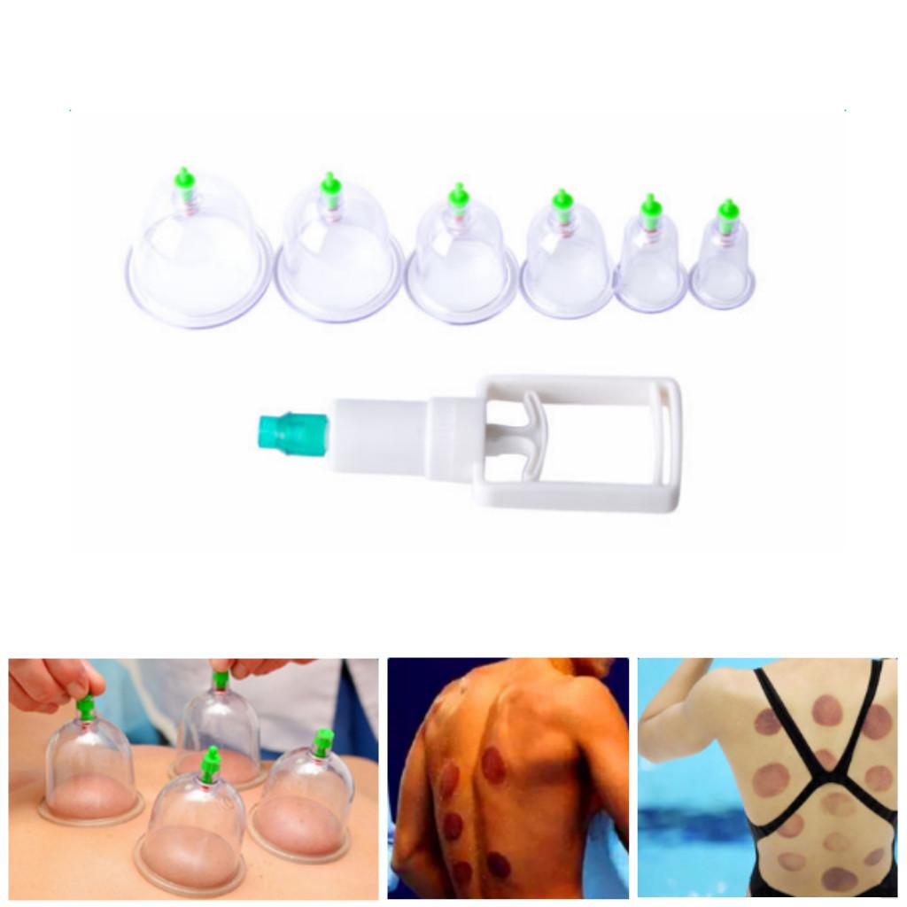 6 Chinese Healthy Body Cupping Magnet Massage Vacuum Suction Cup Set
