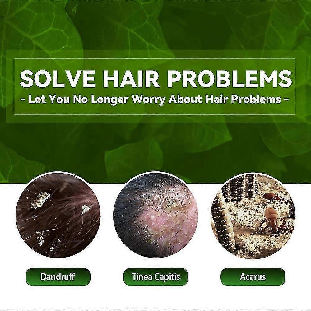 EELHOE Anti-tinea and Anti-itching Shampoo, Anti-hair Loss, Refreshing, Oil-controlling, Anti-dandruff and Anti-itching Shampoo