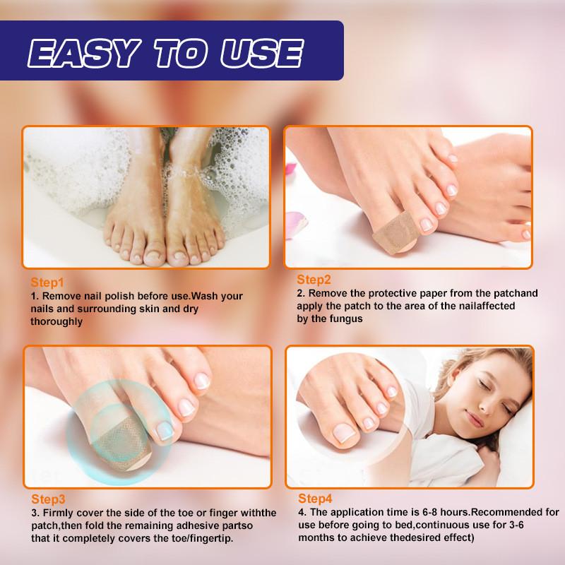 Hbesty Toenail Repair Patches For Damaged Soft Nails With Herbal Scented Comfort 40 Count
