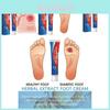 Ximonth 20g Deeply Moisturizing Nourishing Foot Cream For Skin Relief