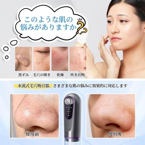 [New Model In 2024] Pore Suction Device, Water Flow Type, Pore Cleaning, Pore Care, Facial Device, Water Tank Separation, Vacuum Suction Technology, P