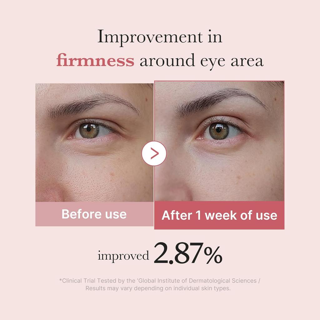 Medicube Salmon DNA PDRN Pink Peptide Eye Serum with Niacinamide and 99% Pure Retinol - Against Fine Lines