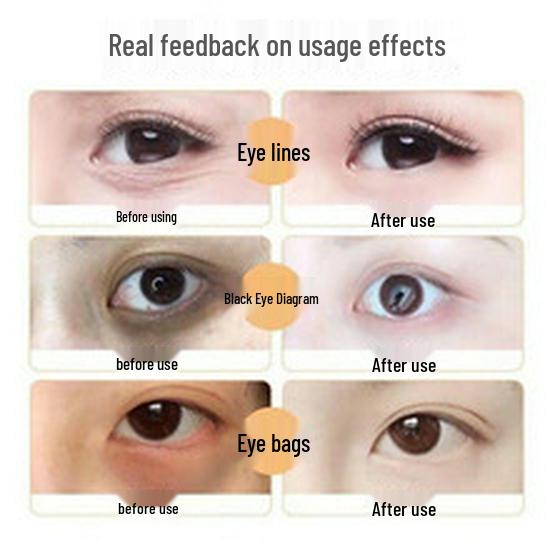 Anti-Wrinkle Eye Cream: Reduces Fine Lines, Bags, Tear Troughs & Crow's Feet; Moisturizes, Fades Dark Circles, Lifts & Firms