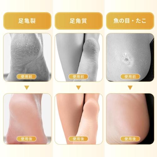 Annhua Natural Pumice Stone, Exfoliating Volcanic Stone, Foot Care Tool, Washable, Reusable, Unisex, Smooth Heels, Skin Care, Heel Shaving, Foot Massa