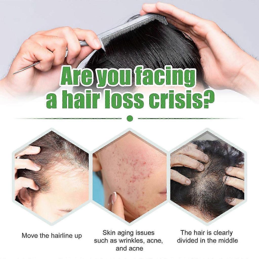 Castor Oil for Hair Growth , Skin Rejuvenation - Deep Moisturizing, Thickening, and Protecting Solution for Dense Black Hair, Eyebrows , Eyelashes - 6