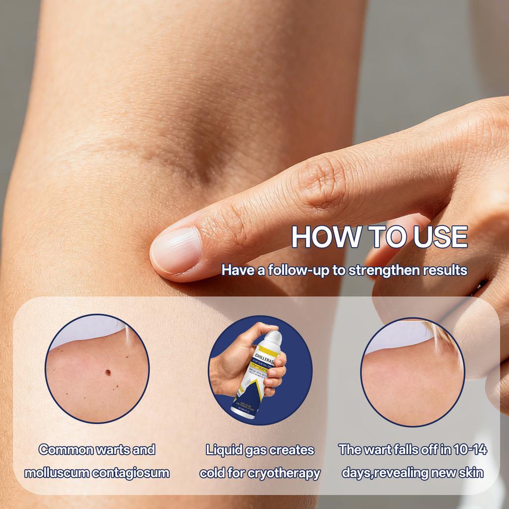 Skin Cleansing Spray, Local Skin Cleansing Spray, Reducing S, Pigmentation, Promoting Skin Growth, 60ml