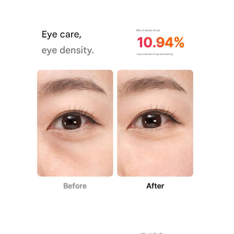 Medicube [Collagen RF] Ultra Tune 40.68