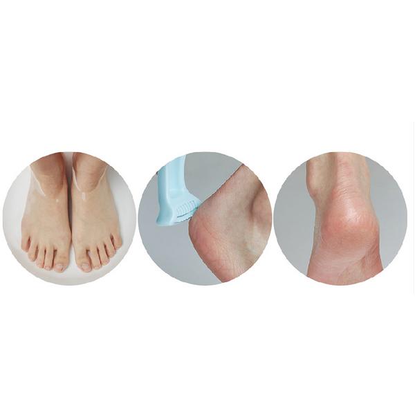 Plu Perfect Foot Callus Razor, 1 Pack, 2 Pieces ,Korean Razor Blade