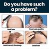 Hair Growth Serum for Hair Loss and Hair Regrowth 60ml*3 Ginger Hair Growth Solution for Men Hair Growth Treatment Repairs Hair Follicles