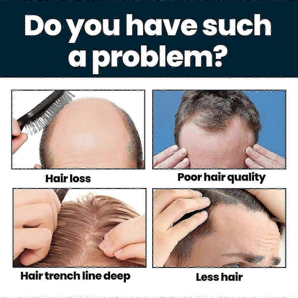 Hair Growth Serum for Hair Loss and Hair Regrowth 60ml*3 Ginger Hair Growth Solution for Men Hair Growth Treatment Repairs Hair Follicles