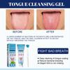 EELHOE Tongue Cleansing Gel (with Tongue Brush) 50g. Oral Hygiene Care. Removes Bad Breath/freshens Breath/reduces Bacterial Growth.