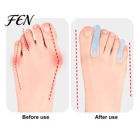 Daily Wear Toe Separator 2PCS Gel Separator, Soft Flared Spreader Straightener, Ultra-Thin Non-Slip Non-slip Comfortable Bunion Corrector, for