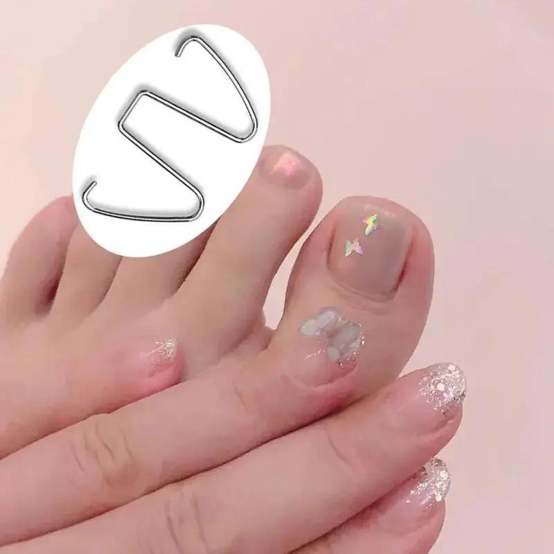 Nagelkorrekturdraht, Gerät zur Korrektur eingewachsener Nägel, Nagelschneiden, Korrekturdraht für eingewachsene Nägel, Zehennagelkorrekturhaken