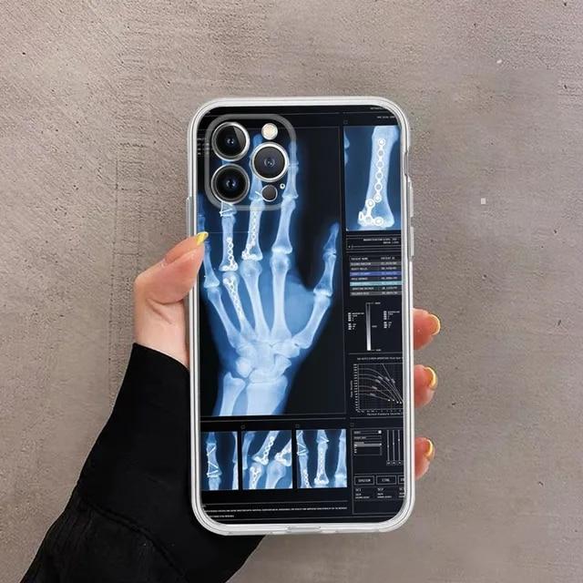 Lovely Animation Fashion Soft Phone For Iphone 8 XS 13 Plus Max 12 Mini 14 6s 7 Pro 11 X XR 6 Silicone TPU Case Cover