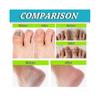 3pcs Foot And Spary, And Powerful Foot Care