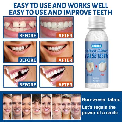 30ML Teeth Glue Fitting Beads Temporary PE Shape Freely Universal Teeth Gel for Home