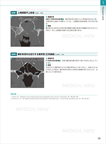 Canal Foramen, Fissure, Space & Membrane: Topographical Anatomy and Image Diagnosis for Interpretation