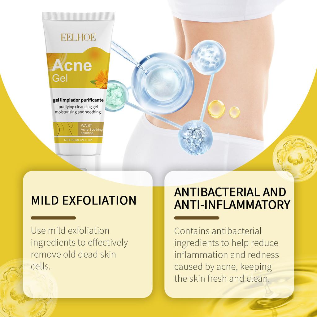 Eelhoe Soothing Acne Gel For Back Acne Gentle Skin Care Hydrating Formula 60ml