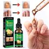 7Days Nail Fungus Treatment Serum Ginger  All Plant Anti-infective Paronychia Onychomycosis Toe Foot Nail Fungal Repair Gel Hand Foot Care