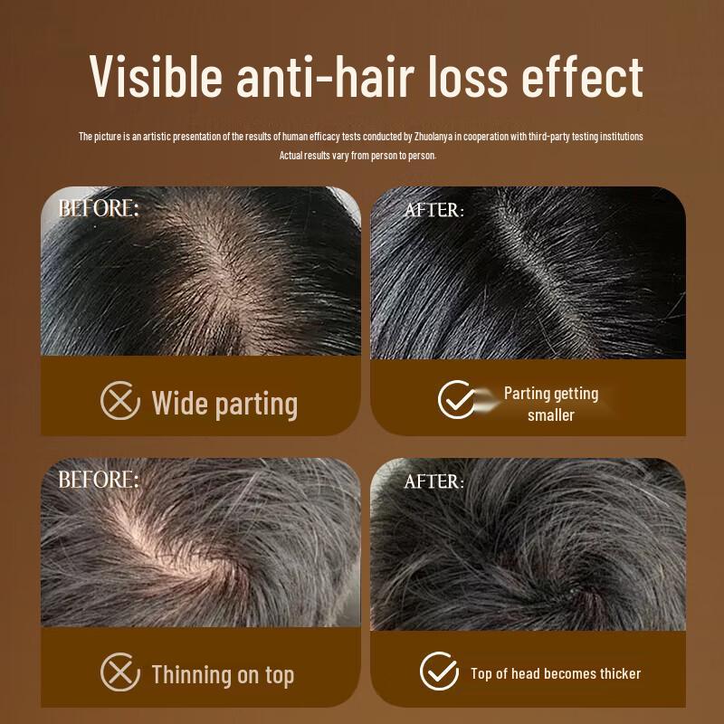 Zhuo Lanya Anti-Hair Loss Hair Growth Liquid