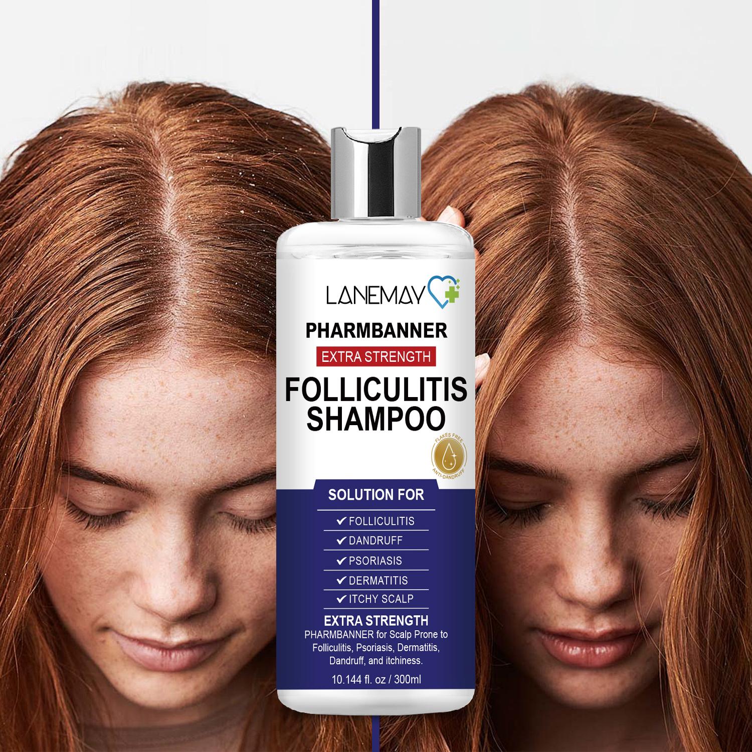 

Pharmbanner Extra Strength Folliculitis Shampoo-Soothes & Restores Scalp-Heals Hair Follicles-Suitable For All Hair Types, 300ml