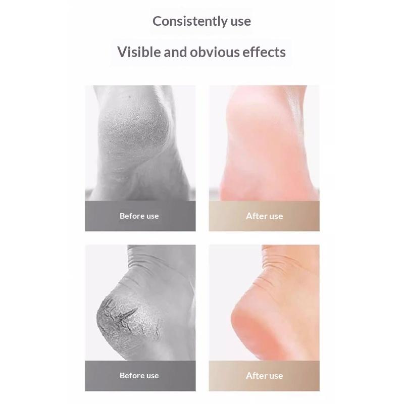 Heel Pads Plantar Fasciitis Support Sleeve Silicone Gel Protector for Heel Pain Relief and Foot Comfort for Work or Home