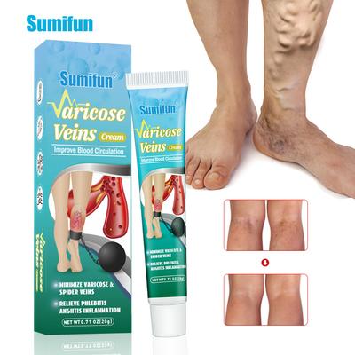 Varicose Veins Cream Herbal Ointment