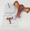 Female Reproductive System Anatomical Model - Uterus and Ovaries