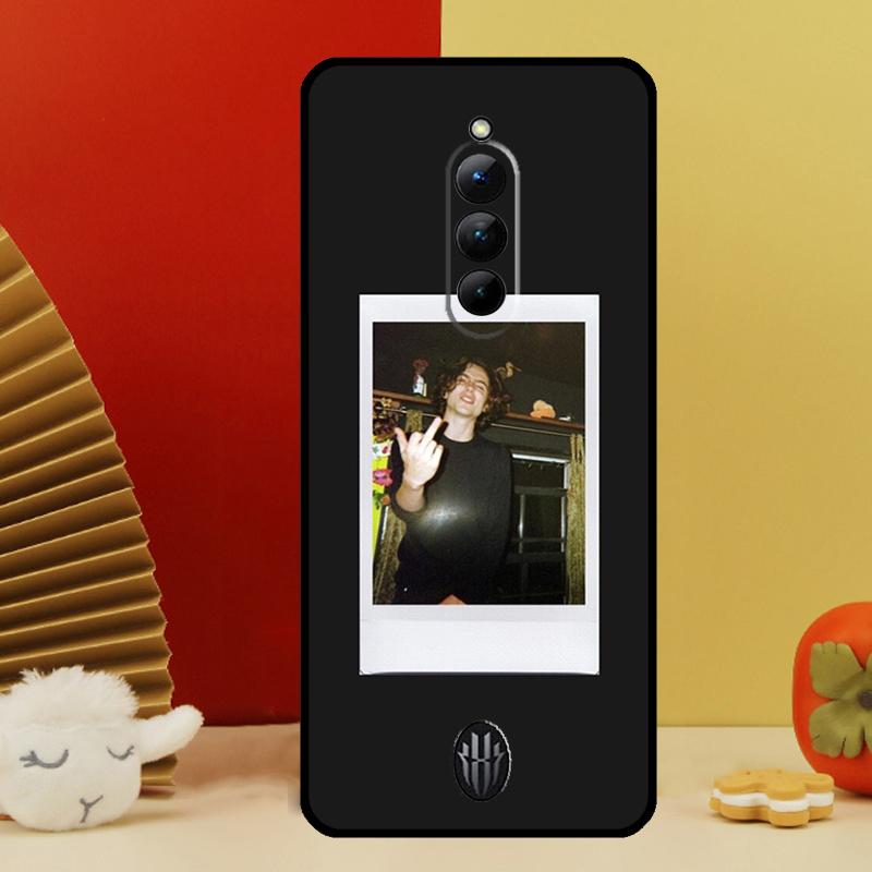 Timothee Chalamet Case For Nubia Red Magic 8 9 10 Pro Plus 6 7 6S 7S Pro 5G 6R RedMagic 9S 8S Pro Plus Cover