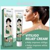 South Moon Vitiligo Cream Gentle Soothing Skin Care Ointment For White Spots
