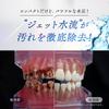 Aimedia Oral Irrigator Jet Washer: Compact, Portable, Cordless, Compatible with Mouthwash, USB Rechargeable, IPX7 Waterproof, 4-Speed