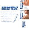 Jaysuing Scar Cream Advanced Formula For Smoothing And Tightening Skin With Post-surgery Scar Treatment For Flawless Results In 30g Packaging