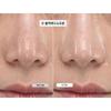 kopher Feuchtigkeitsspendende Barriere Strahlende Elastizität Melder SOS System 1,5 ml*20 Stück(30ml)