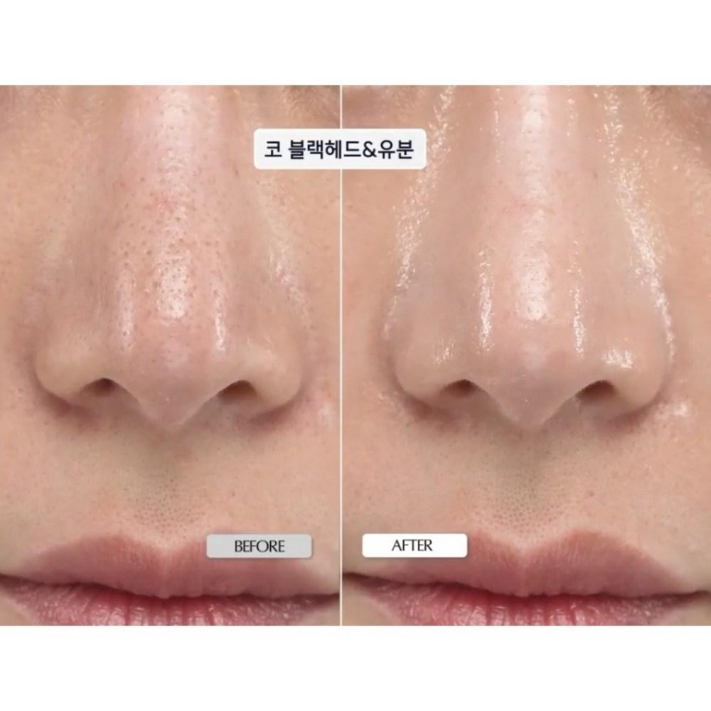 kopher Feuchtigkeitsspendende Barriere Strahlende Elastizität Melder SOS System 1,5 ml*20 Stück(30ml)