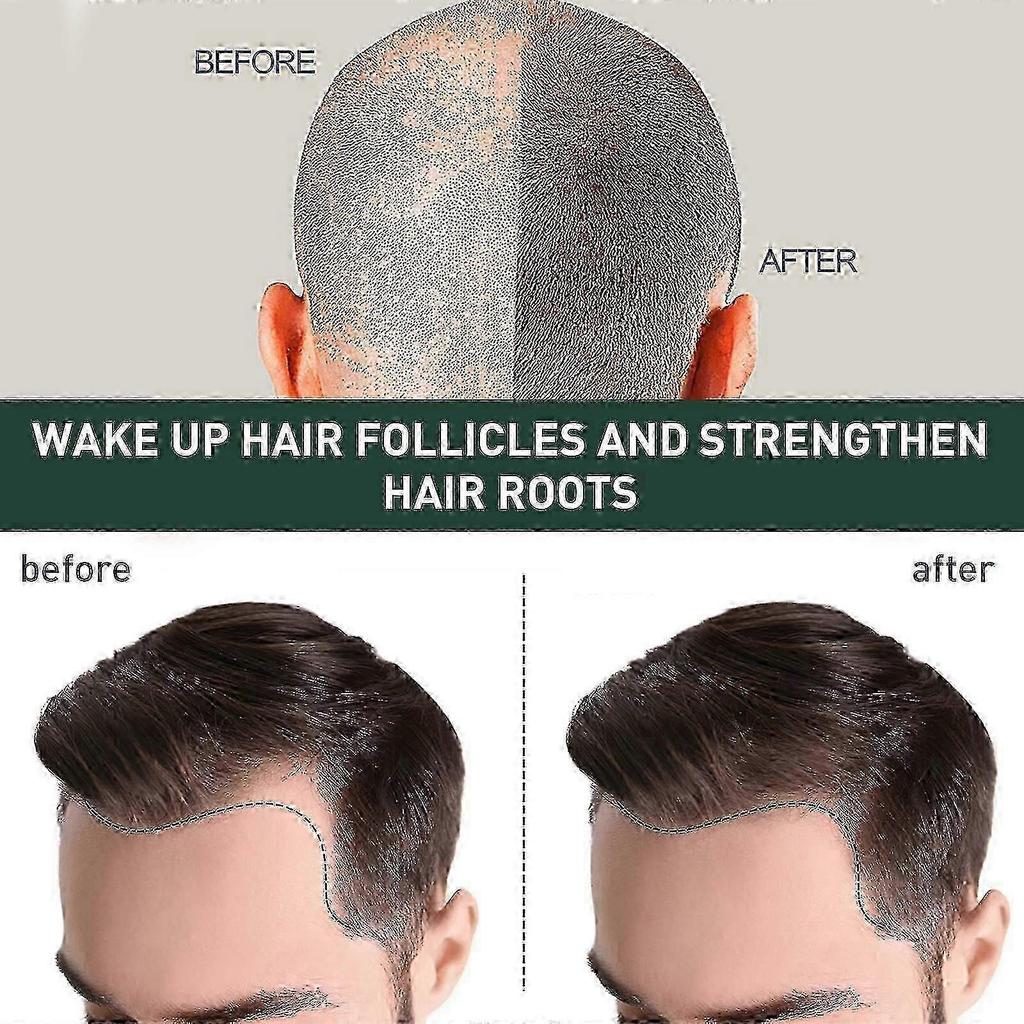 7days Hair Growing Serum, Anti-detachment,hair Development30ml