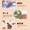 Onychomycosis Relief Lotion: Soothes Discomfort, Reduces Nail Atrophy & Thickening