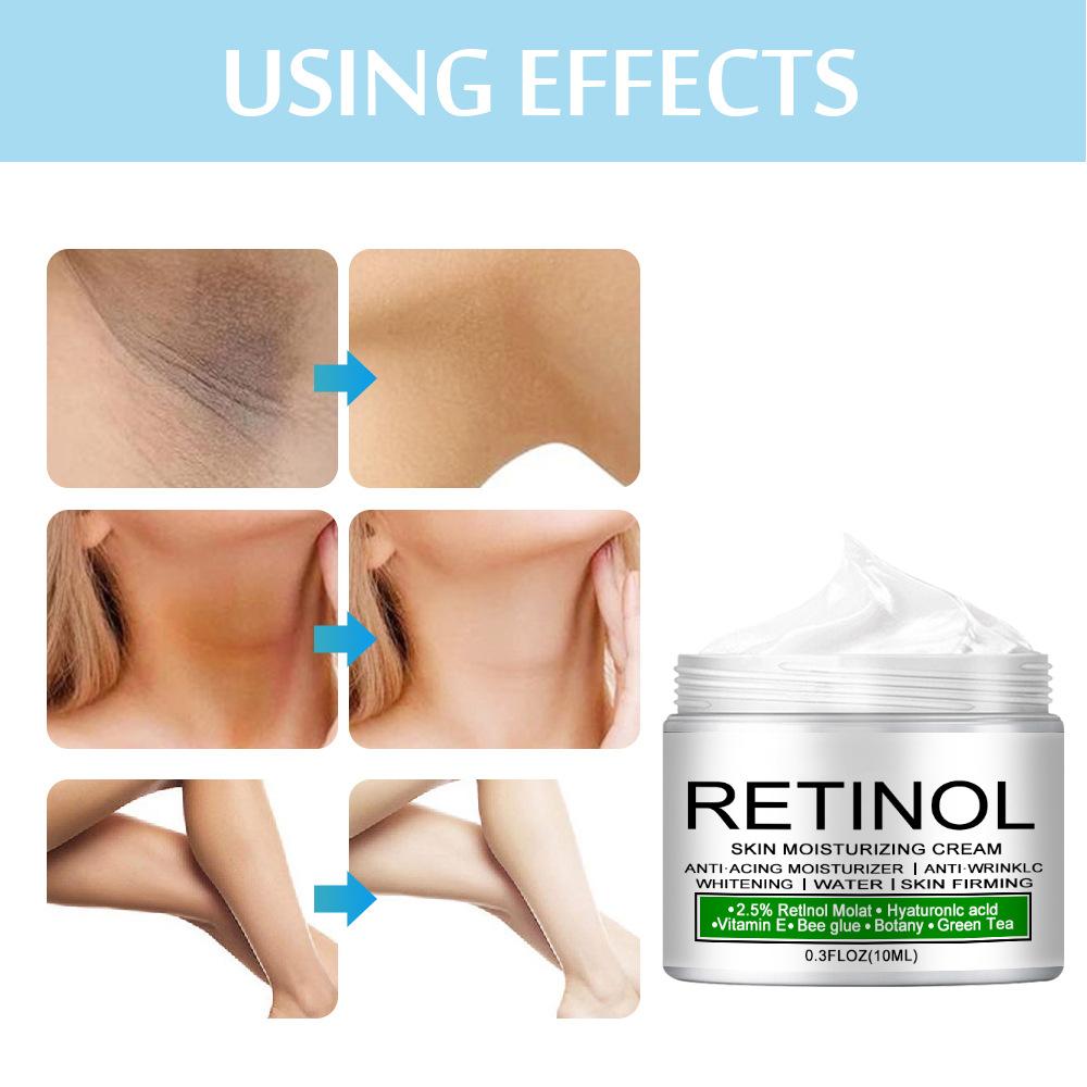 Private Remove Pigmentation Body Whitening Cream Underarm Knee Buttocks Melanin Improve Body Dull Moisturizer Brighten Skin Care