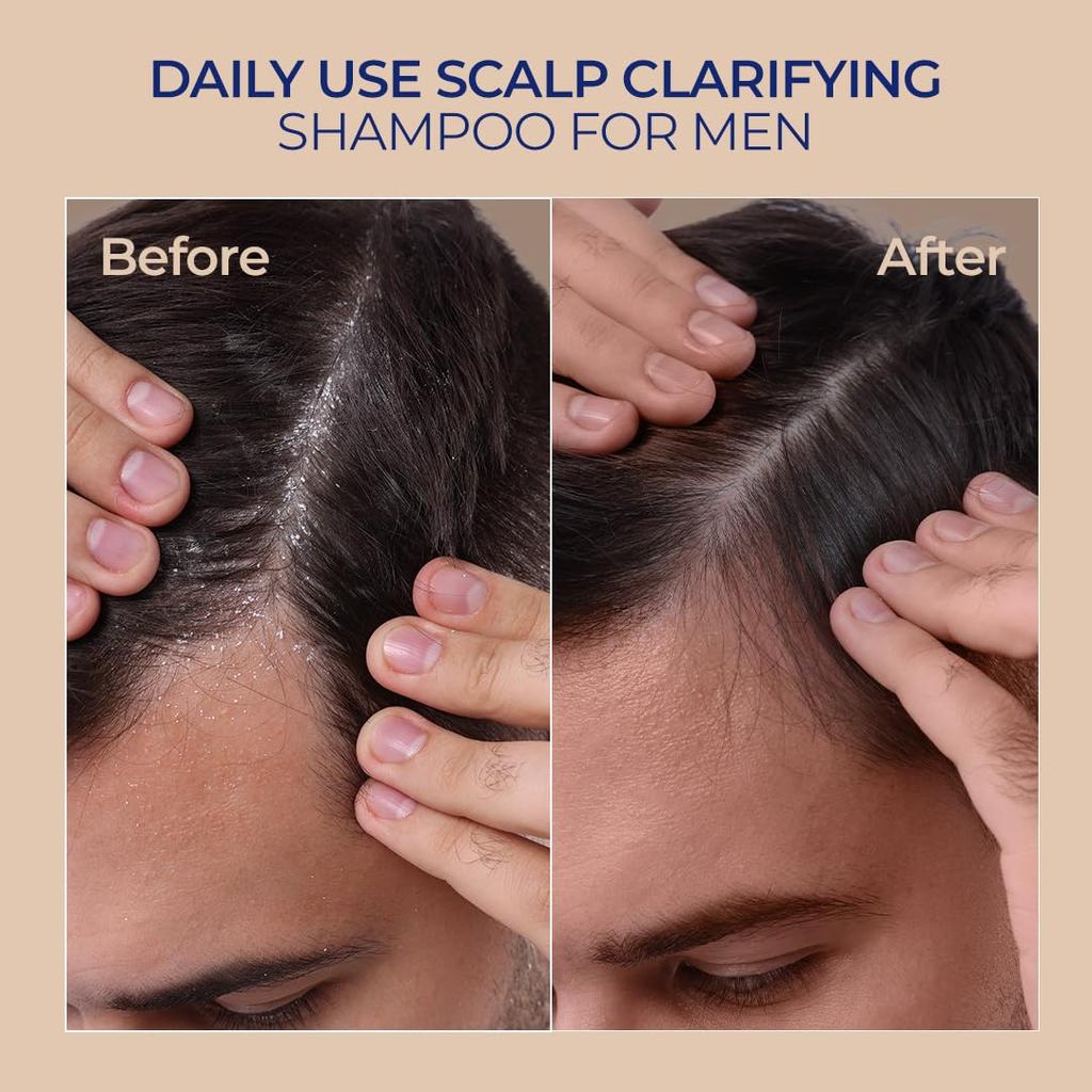 Naturali Scalp Clarifying Anti-Dandruff Shampoo for Men 370 Ml Pack of 1 Sulphate-Free Daily Hair Care